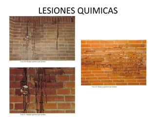 LESIONES QUIMICAS
 