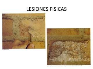 LESIONES FISICAS
 