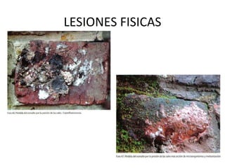 LESIONES FISICAS