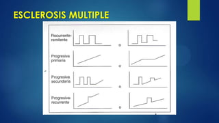 ESCLEROSIS MULTIPLE
 