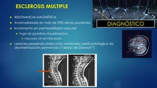  RESONANCIA MAGNÉTICA
 Anormalidades en más de 95% de los pacientes
 Incremento en permeabilidad vascular
 Fuga de gadolinio al parénquima
 Marcador útil de inflamación.
 Lesiones perpendiculares a los ventrículos: perfil patológico de
desmielinización perivenosa (“dedos de Dawson”).
DIAGNÓSTICO
ESCLEROSIS MULTIPLE
 