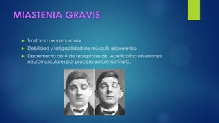 MIASTENIA GRAVIS
 Trastorno neuromuscular
 Debilidad y fatigabilidad de músculo esquelético
 Decremento de # de receptores de Acetilcolina en uniones
neuromusculares por proceso autoinmunitario.
 