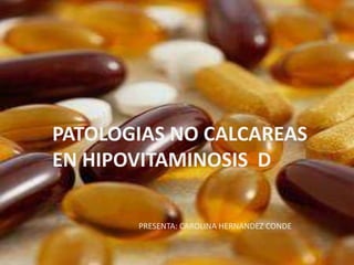 PATOLOGIAS NO CALCAREAS
EN HIPOVITAMINOSIS D

       PRESENTA: CAROLINA HERNANDEZ CONDE
 