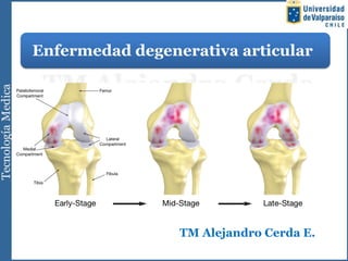 Enfermedad degenerativa articular
TM Alejandro Cerda E.
 