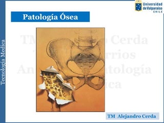 Patología Ósea
TM Alejandro Cerda
 