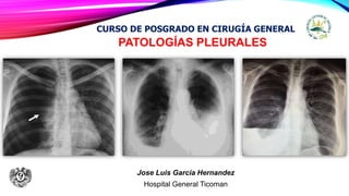 PATOLOGÍAS PLEURALES
Jose Luis Garcia Hernandez
Hospital General Ticoman
CURSO DE POSGRADO EN CIRUGÍA GENERAL
 