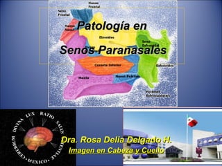 Patología en   Senos Paranasales    Dra. Rosa Delia Delgado H. Imagen en Cabeza y Cuello 