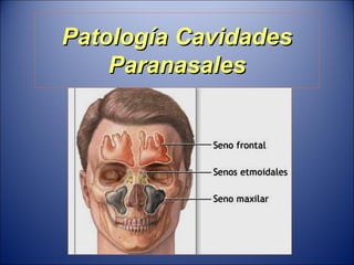Patología Cavidades Paranasales 