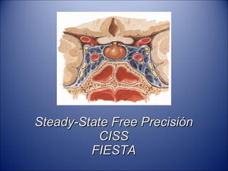 Steady-State Free Precisión CISS FIESTA 