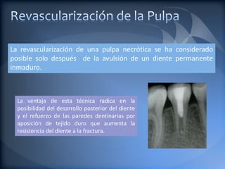 La revascularización de una pulpa necrótica se ha considerado
posible solo después de la avulsión de un diente permanente
inmaduro.



  La ventaja de esta técnica radica en la
  posibilidad del desarrollo posterior del diente
  y el refuerzo de las paredes dentinarias por
  aposición de tejido duro que aumenta la
  resistencia del diente a la fractura.
 