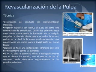 Técnica
•Desinfección del conducto con instrumentación
mecánica.
•Irrigación capciosa con NaOCL al 5.25; así como una
combinación de antibióticos. (estos dos primeros pasos
traen como consecuencia la formación de un coágulo
sanguíneo a nivel del diente donde se realiza la técnica,
podría ser a nivel de la unión amelocementaria, para
proporcionar una matriz para la invaginación del nuevo
tejido.)
•Seguido se hace una restauración coronaria que sella
herméticamente contra las bacterias.
•Al los 30 días se observara clínica y radiográficamente
que el diente ha sanado, con el control de las 20
semanas puede observarse engrosamiento de las
paredes radiculares .
 