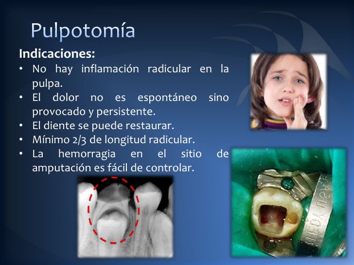 Patologias pulpares