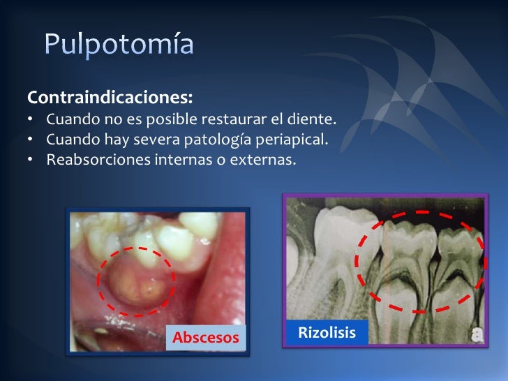Patologias pulpares