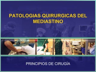 PATOLOGIAS QUIRURGICAS DEL
MEDIASTINO

PRINCIPIOS DE CIRUGÍA

 