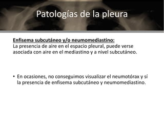 Patologias radiologicas de torax