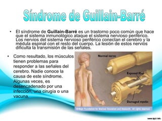 • El síndrome de Guillain-Barré es un trastorno poco común que hace 
que el sistema inmunológico ataque el sistema nervioso periférico. 
Los nervios del sistema nervioso periférico conectan el cerebro y la 
médula espinal con el resto del cuerpo. La lesión de estos nervios 
dificulta la transmisión de las señales. 
• Como resultado, los músculos 
tienen problemas para 
responder a las señales del 
cerebro. Nadie conoce la 
causa de este síndrome. 
Algunas veces, es 
desencadenado por una 
infección, una cirugía o una 
vacuna. 
