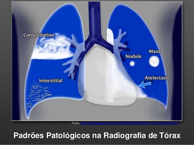Resultado de imagem para rx com laudo