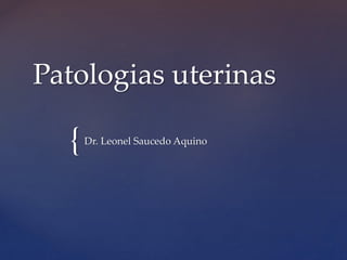 {
Patologias uterinas
Dr. Leonel Saucedo Aquino
 