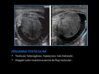Patologia Testicular