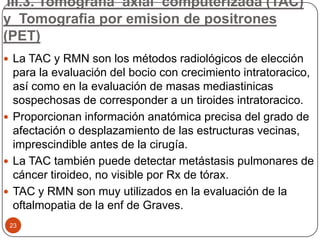 III.3. Tomografia axial computerizada (TAC)
y Tomografia por emision de positrones
(PET)
23
 La TAC y RMN son los métodos radiológicos de elección
para la evaluación del bocio con crecimiento intratoracico,
así como en la evaluación de masas mediastinicas
sospechosas de corresponder a un tiroides intratoracico.
 Proporcionan información anatómica precisa del grado de
afectación o desplazamiento de las estructuras vecinas,
imprescindible antes de la cirugía.
 La TAC también puede detectar metástasis pulmonares de
cáncer tiroideo, no visible por Rx de tórax.
 TAC y RMN son muy utilizados en la evaluación de la
oftalmopatia de la enf de Graves.
 