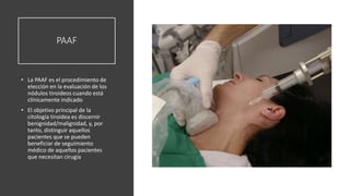 Paaf Patologia tiroidea | PPTX