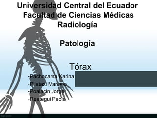 Universidad Central del Ecuador
Facultad de Ciencias Médicas
Radiología
Patología
Tórax
-Pachacama Karina
-Pilataxi Marcelo
-Poalacin Jorge
-Reategui Paola
 