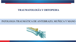 TRAUMATOLOGÍAY ORTOPEDIA
PATOLOGIA TRAUMÁTICA DE ANTEBRAZO, MUÑECA Y MANO
 