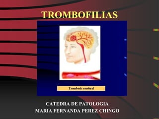 TROMBOFILIAS CATEDRA DE PATOLOGIA MARIA FERNANDA PEREZ CHINGO 