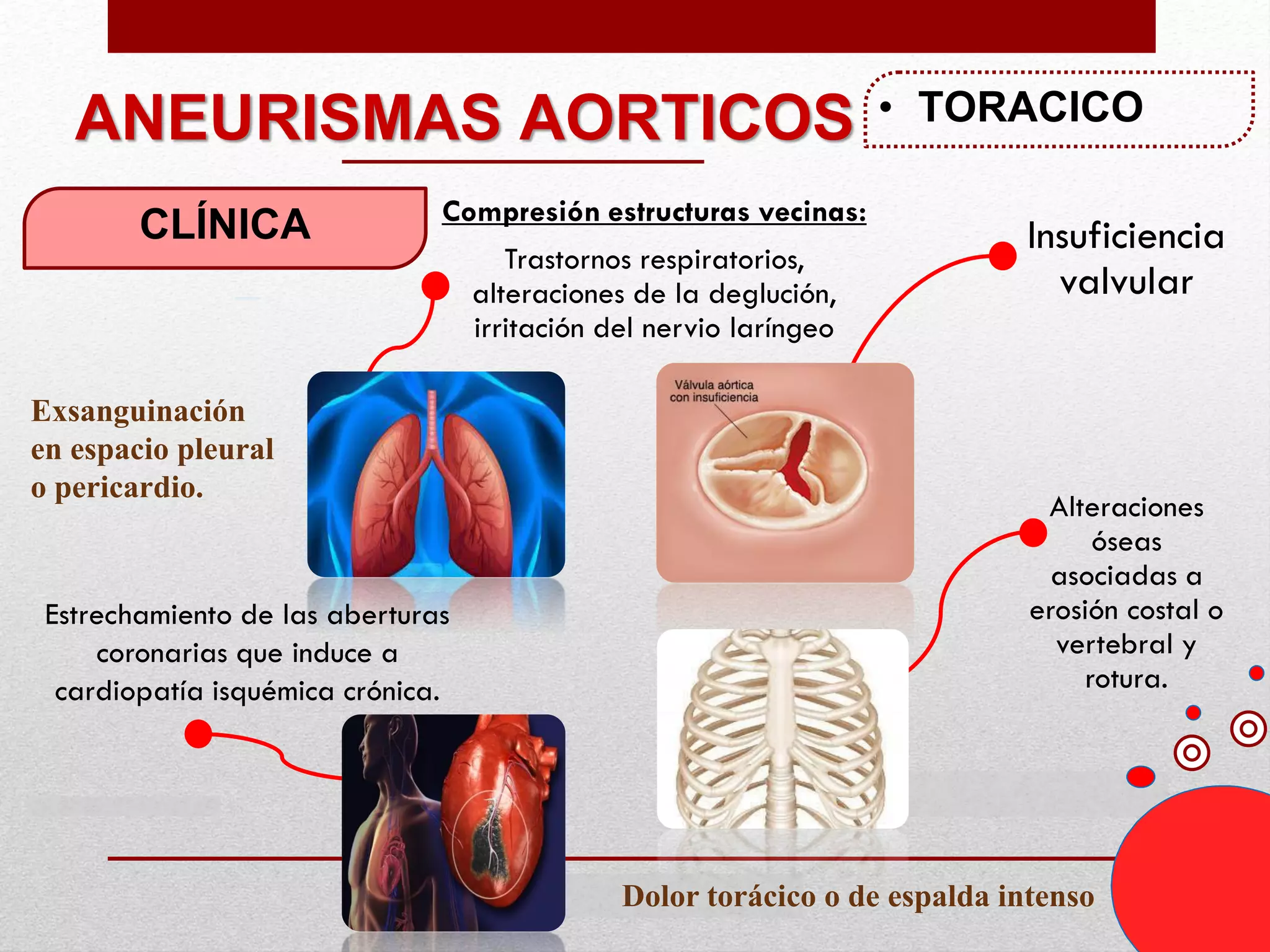 PATOLOGIA VASCULAR. ANEURISMAS Y PSEUDOANEURISMAS.pdf