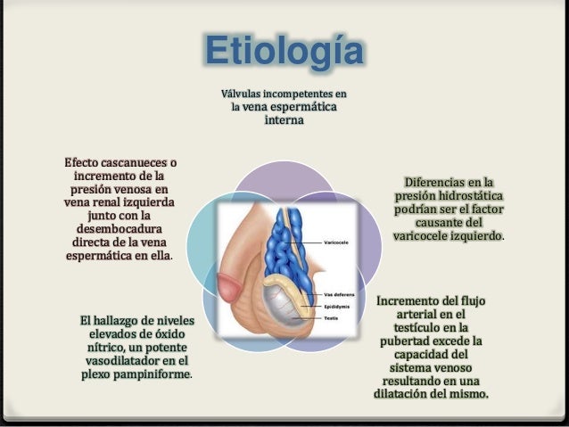 Si la vagina grande y un pequeño miembro