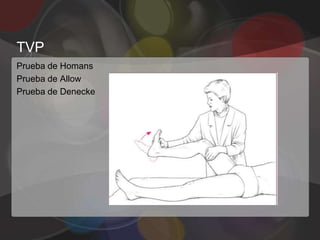 TVP
Prueba de Homans
Prueba de Allow
Prueba de Denecke
 