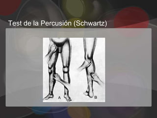 Test de la Percusión (Schwartz)
 
