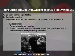 DOPPLER DE ONDA CONTÍNUA BIDIRECCIONAL O CONVENCIONAL

1. Se usan aparatos portátiles
2. Bastante sencillo
3. Puede ser realizado por personas con mínimo de entrenamiento

     Aplicaciones:
   - Para evaluaciones rápidas
   - Busca principalmente reflujos por insuficiencia valvular en los
     sistemas venosos superficial y profundo




           PROLAPSO DE LA VALVULA HACIA LA VSI
 