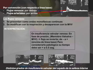 Por convención (con respecto a línea base):
- Flujos venosos: por debajo
- Flujos arteriales: por arriba

Los flujos venosos:
1. Se presentan como ondas monofásicas continuas
2. Se modifican con la respiración y desaparecen con la MVV
INTERPRETACIÓN:

                         En insuficiencia valvular venosa: En
                         fase de presión, (Maniobra Valsalva –
                         MVV)  flujo se invierte; de – a +
                         (encima de línea base) Para
                         considerarlo patológico su tiempo
                         debe ser > a 0.5 seg.




  Distintos grados de insuficiencia valvular del cayado de la safena interna
 