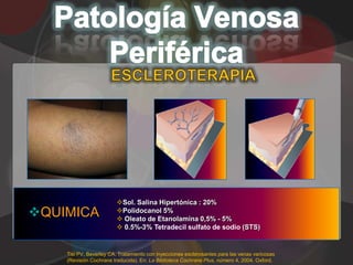 Sol. Salina Hipertónica : 20%
QUIMICA                 Polidocanol 5%
                          Oleato de Etanolamina 0,5% - 5%
                          0.5%-3% Tetradecil sulfato de sodio (STS)


    Tisi PV, Beverley CA. Tratamiento con inyecciones esclerosantes para las venas varicosas
    (Revisión Cochrane traducida). En: La Biblioteca Cochrane Plus, número 4, 2004. Oxford,
 