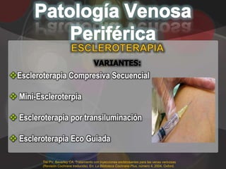 Escleroterapia Compresiva Secuencial

 Mini-Escleroterpia

 Escleroterapia por transiluminación

 Escleroterapia Eco Guiada

         Tisi PV, Beverley CA. Tratamiento con inyecciones esclerosantes para las venas varicosas
         (Revisión Cochrane traducida). En: La Biblioteca Cochrane Plus, número 4, 2004. Oxford,
 