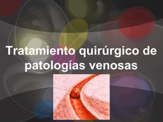 Tratamiento quirúrgico de
   patologías venosas
 