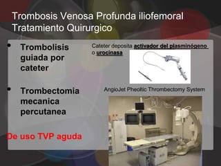 Trombosis Venosa Profunda iliofemoral
    Tratamiento Quirurgico
•    Trombolisis     Cateter deposita activador del plasminógeno
                     o urocinasa
     guiada por
     cateter

•    Trombectomia        AngioJet Pheoltic Thrombectomy System

     mecanica
     percutanea

De uso TVP aguda
 