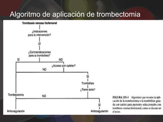 Algoritmo de aplicación de trombectomia
 
