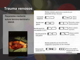 Trauma venosos

Reparadas mediante
sutura término-terminal o
   lateral.
 