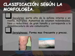 CLASIFICACIÓN SEGÚN LA
MORFOLOGÍA.
     Saculares: parte alta de la safena interna y en
 rodilla, múltiples. Aumentos de volumen redondeados,
 lisos y reducibles; de gran tamaño y corresponde a la
 desembocadura de una comunicante.

    Serpiginosas: Forma mas frecuente y precoz.




                  Del Agila Hoyos L. Várices de Miembros Inferiores.
 