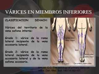VÁRICES EN MIEMBROS INFERIORES
CLASIFICACION       DEHACH:

Várices del territorio de la
vena safena interna:

Grado 1: várice de la rama
lateral incipiente de la vena
accesoria lateral.

Grado 2: várice de la rama
lateral incipiente de la vena
accesoria lateral y de la vena
safena accesoria.

                       Arnoldi, C.C. The aetiology of primary Varicose
                       Veins. Dan. Med. Bull. 1957,4,102-107.
 