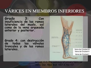 VÁRICES EN MIEMBROS INFERIORES
Grado        3:        Con
insuficiencia de las ramas
laterales del muslo, así
como de la vena arqueada
anterior y posterior.


Grado 4: con destrucción
de todas las válvulas
troncales y de las ramas
laterales.                                                 Vena de Crocket III
                                                           Vena de Crocket II
                                                           Vena de Crocket I



                    Arnoldi, C.C. The aetiology of primary Varicose
                    Veins. Dan. Med. Bull. 1957,4,102-107.
 