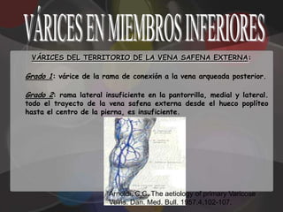 VÁRICES DEL TERRITORIO DE LA VENA SAFENA EXTERNA:

Grado 1: várice de la rama de conexión a la vena arqueada posterior.

Grado 2: rama lateral insuficiente en la pantorrilla, medial y lateral.
todo el trayecto de la vena safena externa desde el hueco poplíteo
hasta el centro de la pierna, es insuficiente.




                        Arnoldi, C.C. The aetiology of primary Varicose
                        Veins. Dan. Med. Bull. 1957,4,102-107.
 