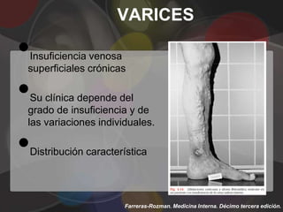 VARICES

•
Insuficiencia venosa
superficiales crónicas

•Su clínica depende del
grado de insuficiencia y de
las variaciones individuales.

•   Distribución característica




                         Farreras-Rozman. Medicina Interna. Décimo tercera edición.
 