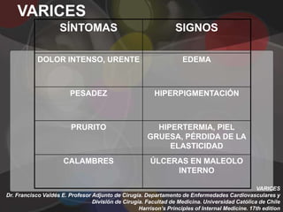 VARICES
                    SÍNTOMAS                                      SIGNOS

            DOLOR INTENSO, URENTE                                   EDEMA



                        PESADEZ                          HIPERPIGMENTACIÓN



                         PRURITO                         HIPERTERMIA, PIEL
                                                       GRUESA, PÉRDIDA DE LA
                                                            ELASTICIDAD
                      CALAMBRES                         ÚLCERAS EN MALEOLO
                                                             INTERNO

                                                                                                 VARICES
Dr. Francisco Valdés E. Profesor Adjunto de Cirugía. Departamento de Enfermedades Cardiovasculares y
                                 División de Cirugía. Facultad de Medicina. Universidad Católica de Chile
                                                   Harrison’s Principles of Internal Medicine. 17th edition
 