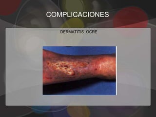 COMPLICACIONES

   DERMATITIS OCRE
 