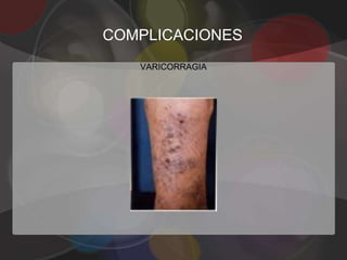 COMPLICACIONES
   VARICORRAGIA
 