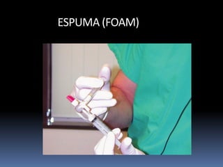 ESPUMA (FOAM)
 