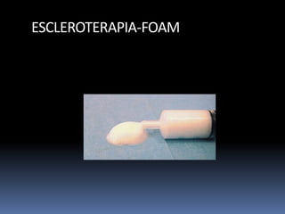 ESCLEROTERAPIA-FOAM
 